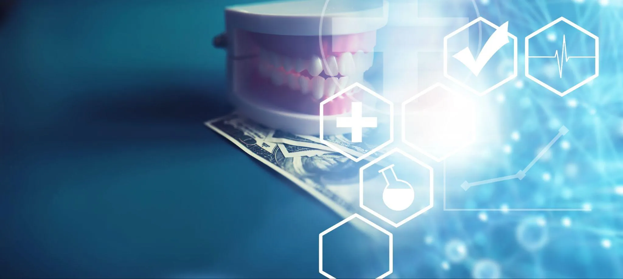 前歯のインプラントの費用相場と治療期間