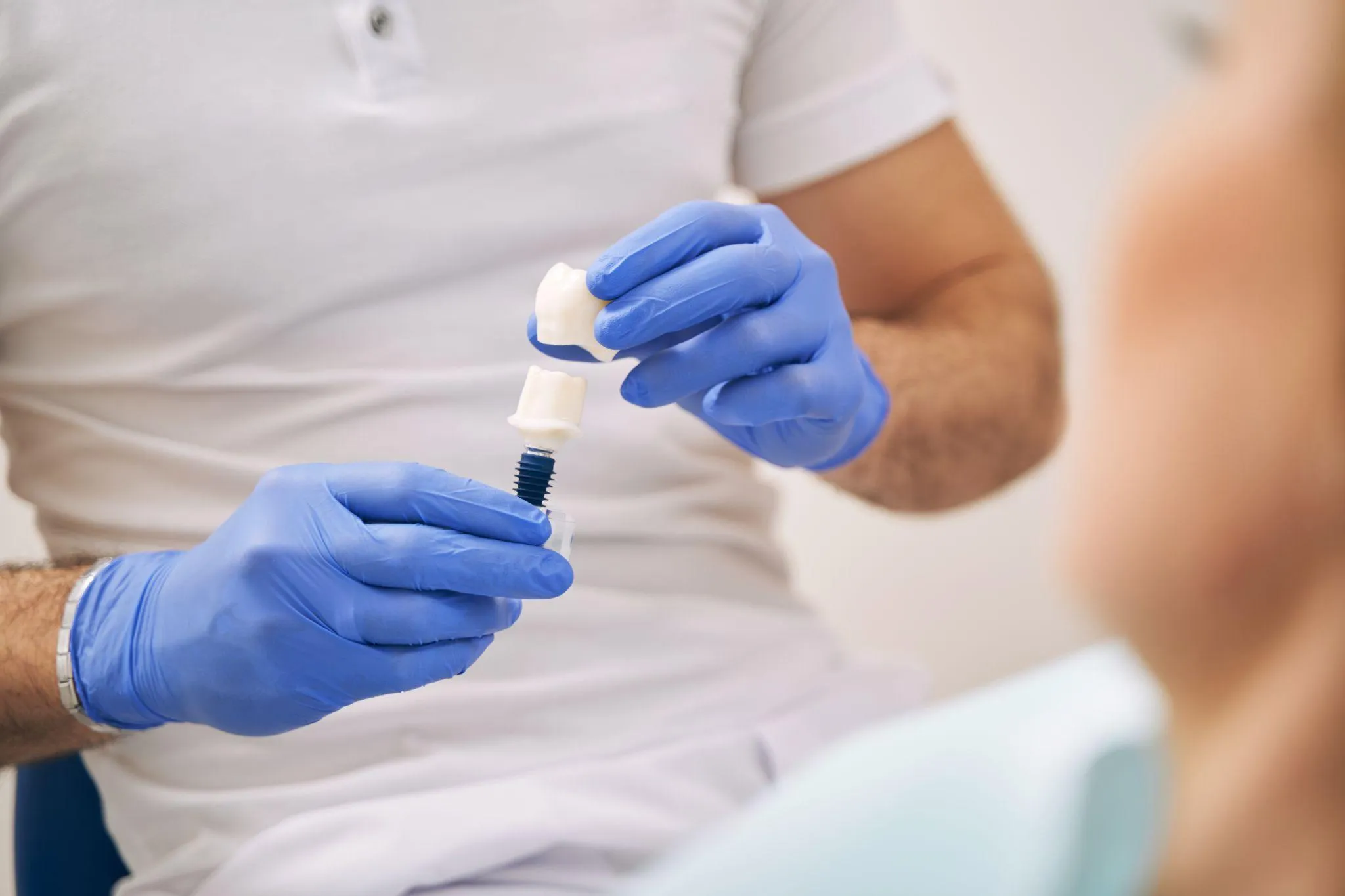 インプラントの寿命はどのくらい？