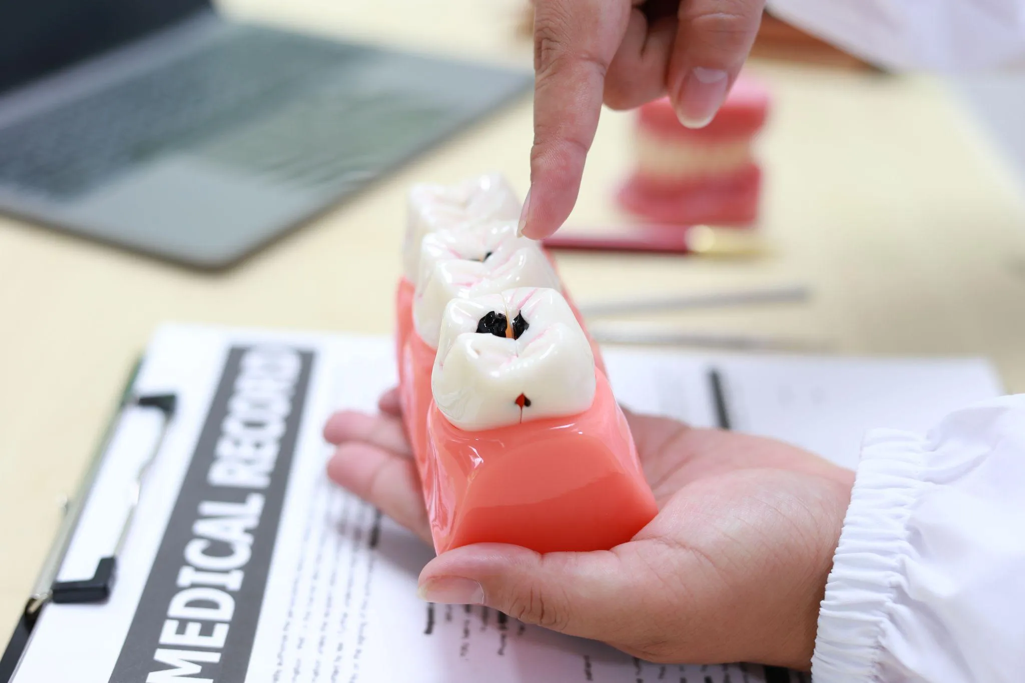 インプラントが寿命を迎えた場合の再治療や選択肢